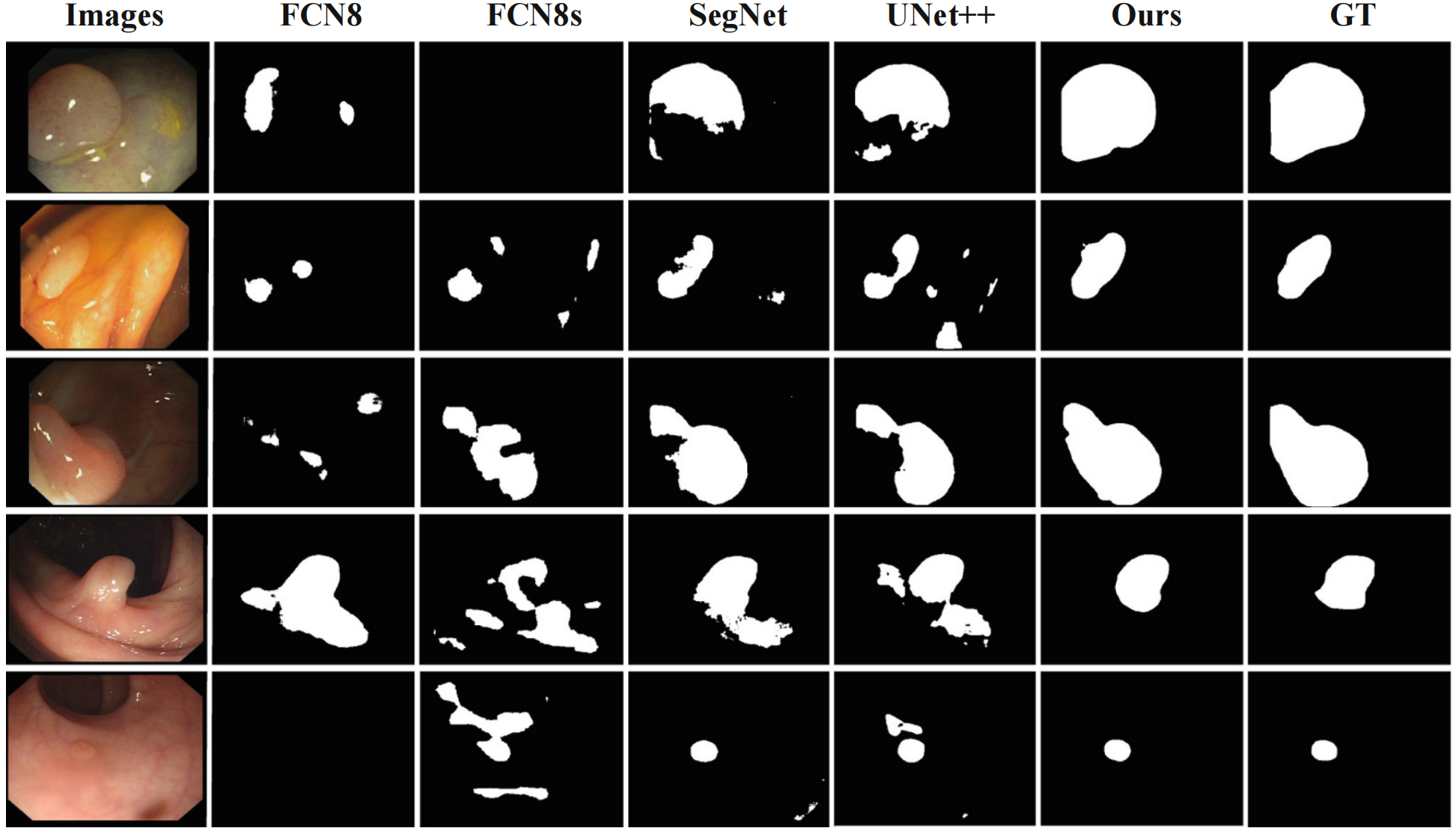 Selective feature aggregation network with area-boundary constraints for polyp segmentation